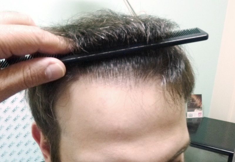 AfterFrontView.jpg
